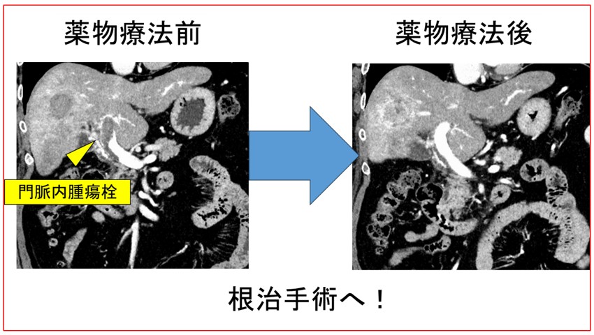 薬物療法