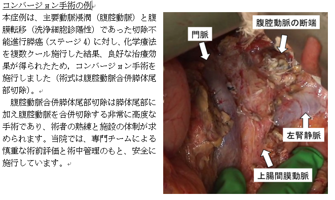 コンバージョン手術の例