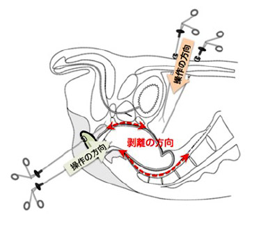 図5：TaTMEの概略