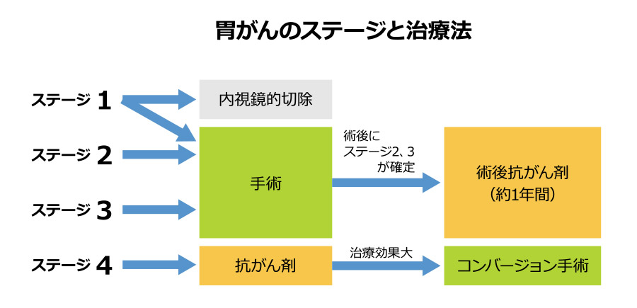 胃がんのステージと治療法