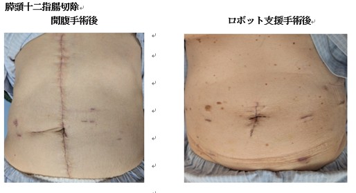 診断時に切除不能と診断された進行膵がんに対しても積極的治療を行っています。