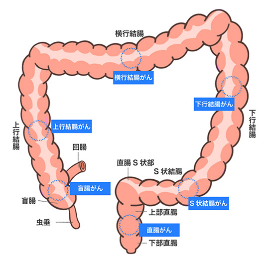 図1：大腸の模式図