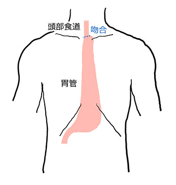 外科的治療