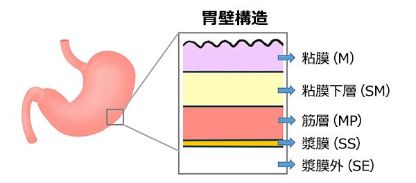 胃の構造