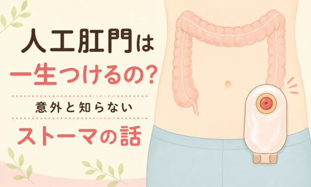 人工肛門は一生つけるの？ ― 意外と知らない「ストーマ」の話